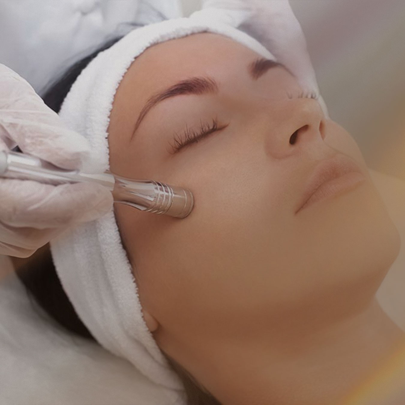 Peeling de Diamante - Cínica Hedaya